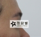 비절개 코성형 …